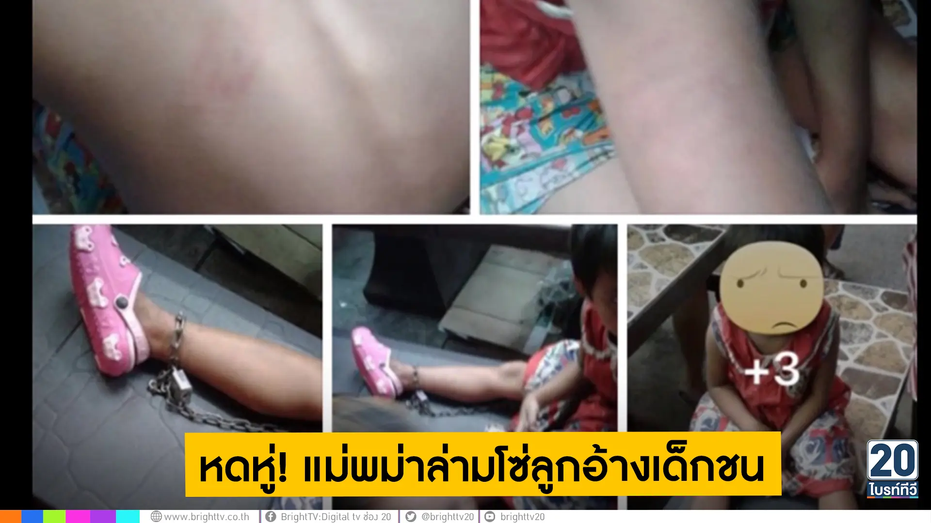 หดหู่! แม่พม่าล่ามโซ่ลูกอ้างเด็กชน