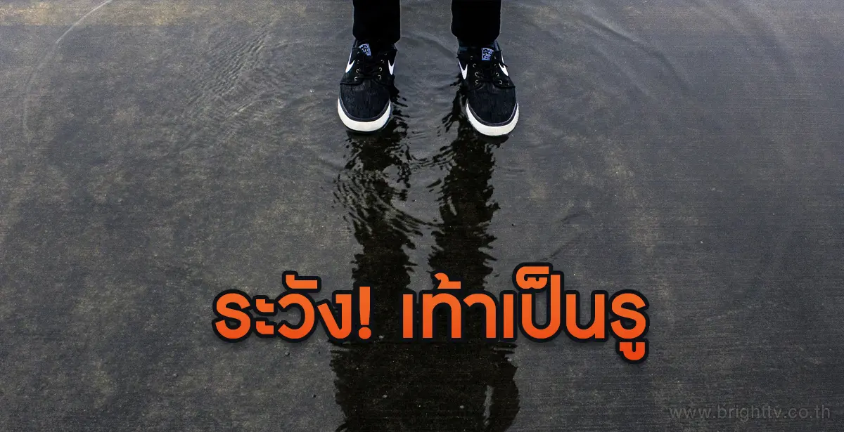 เท้าเป็นรู