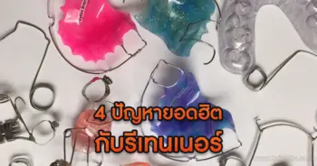 รีเทนเนอร์