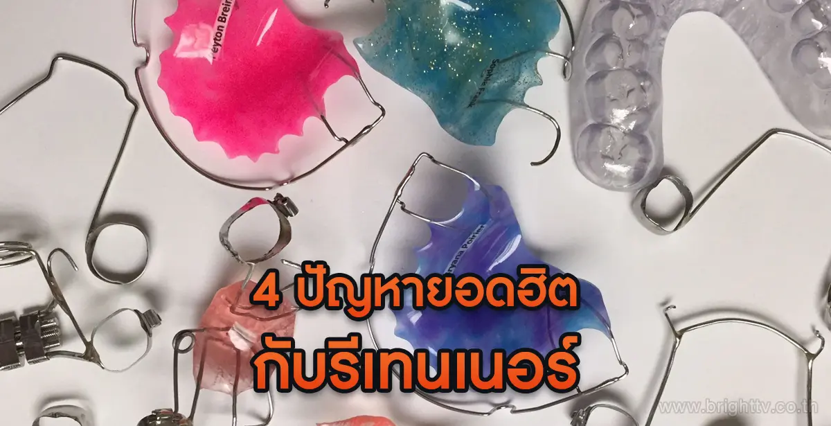 รีเทนเนอร์