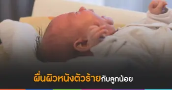 ผื่นผิวหนัง
