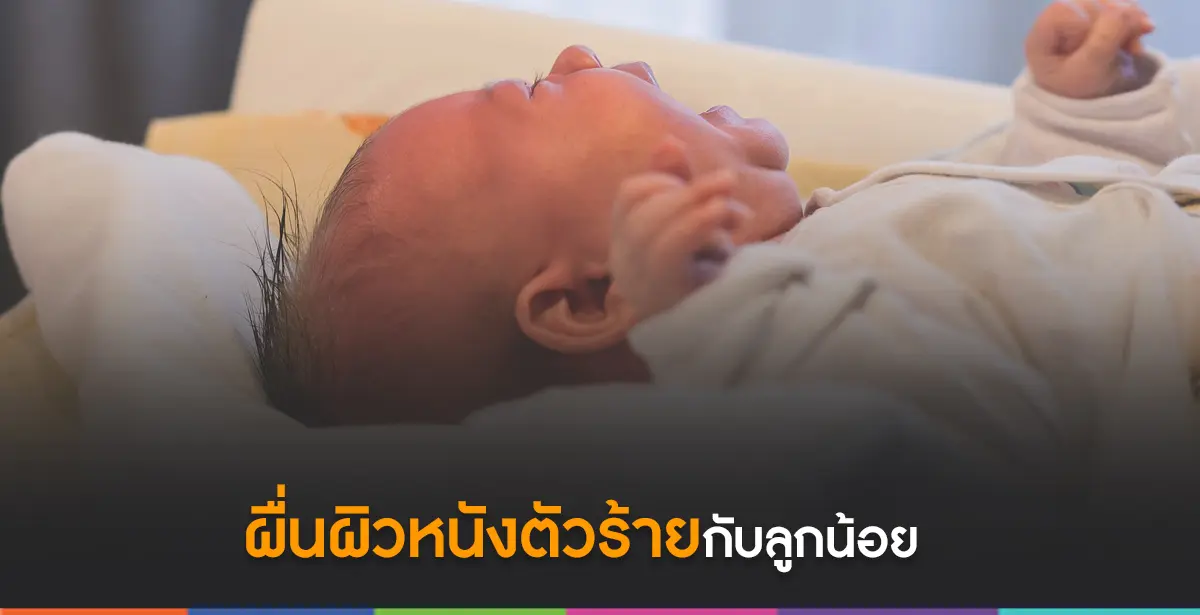 ผื่นผิวหนัง