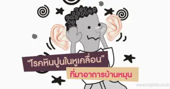 โรคหินปูนในหูเคลื่อน