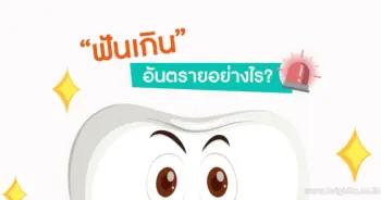 ฟันเกิน