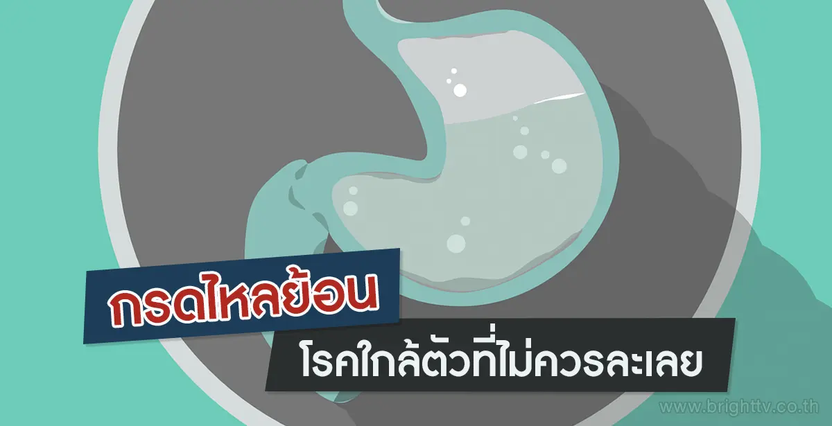 กรดไหลย้อน