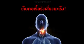 เจ็บคอเรื้อรังเสี่ยงเป็นมะเร็งกล่องเสียง