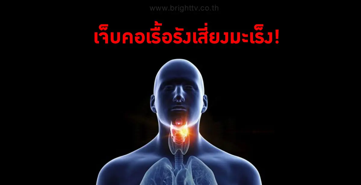 เจ็บคอเรื้อรังเสี่ยงเป็นมะเร็งกล่องเสียง