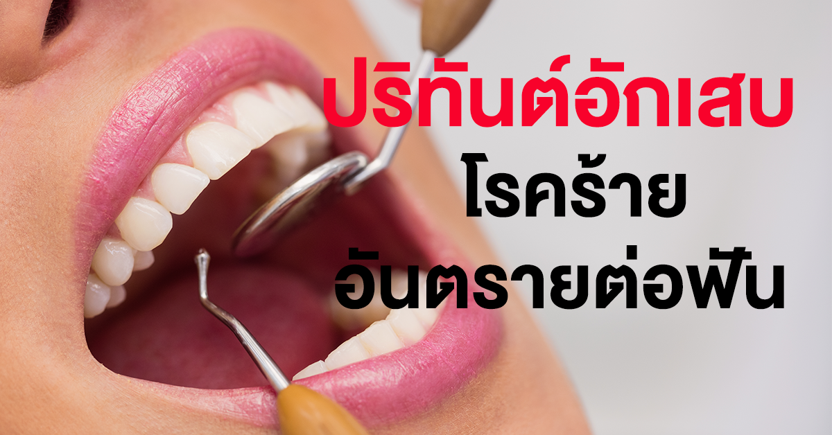 ปริทันต์อักเสบ