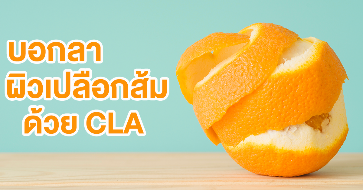 3 วิธี กำจัด เซลลูไลท์ อย่างไรให้ปลอดภัย 3 วิธี กำจัด เซลลูไลท์ อย่างไรให้ปลอดภัย