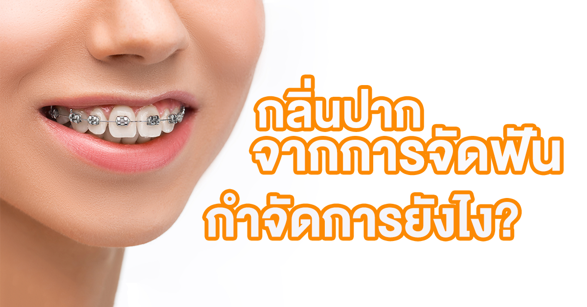 จัดฟัน กลิ่นปาก