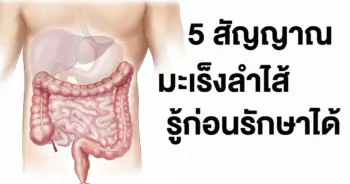 มะเร็งลำไส้