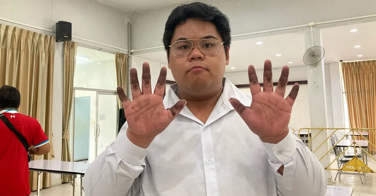 ฟรานซิส บุญเกื้อหนุน