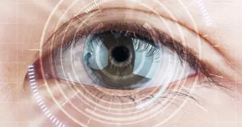 Cataract