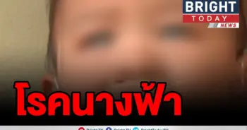พบเด็กป่วยโรคนางฟ้า