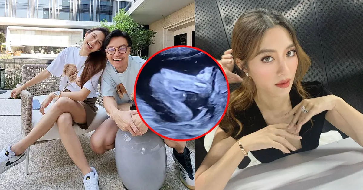 มิว นิษฐา ท้อง