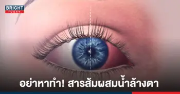 โรคตาแดง แฝงมากับหน้าฝน เตือน อย่าหาทำ