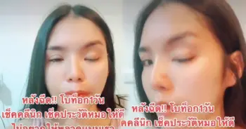 ฉีดโบท็อกซ์