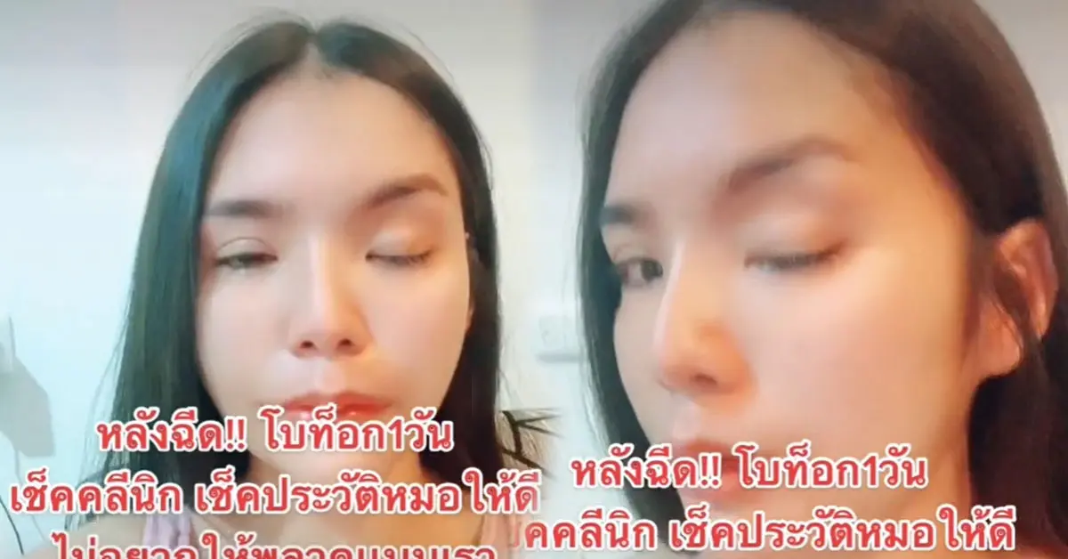 ฉีดโบท็อกซ์