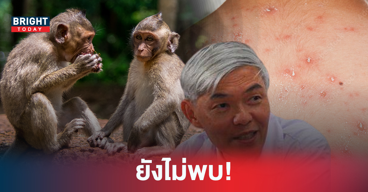 อย่าตื่นตระหนก! หมอยง เผย ฝีดาษลิง ไม่ใช่โรคใหม่ ยังไม่เคยพบในประเทศไทย