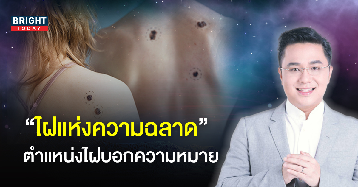 หมอช้าง ทศพร ศรีตุลา เผย ตำแหน่งไฝบอกความหมาย ทำนายความเฉลียวฉลาด หมอช้าง ทศพร ศรีตุลา เผย ตำแหน่งไฝบอกความหมาย ทำนายความเฉลียวฉลาด