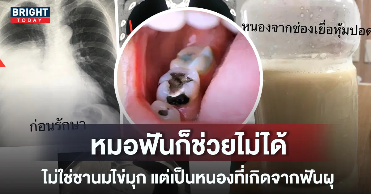 หนอง