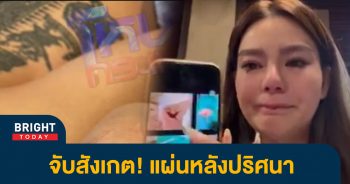 รอยสัก-แผล-ดิว