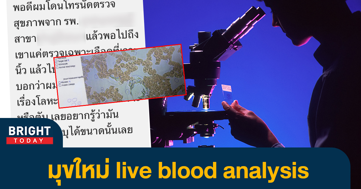 เพจดังเตือน หลอกตรวจเลือด live blood analysis ต้นทุนหลักหน่อย เสียหายหลักแสน