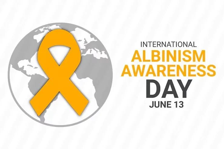international-albinism-awareness