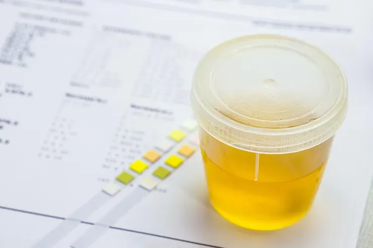 urine-vial-laboratory-toxicology