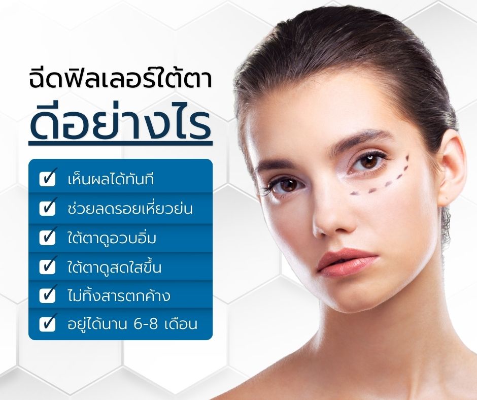 ฉีดฟิลเลอร์ใต้ตา หน้าเด็กลงจริงไหม (2)-min