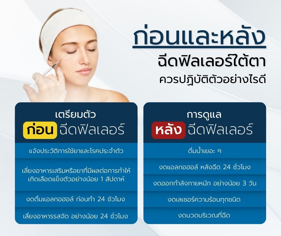 ฉีดฟิลเลอร์ใต้ตา หน้าเด็กลงจริงไหม (4)-min
