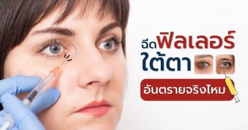 ฉีดฟิลเลอร์ใต้ตา อันตรายจริงไหม (2)-min