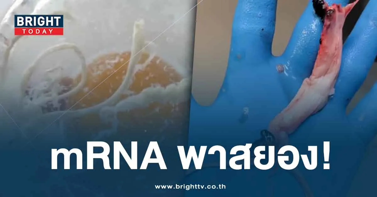 เอฟเฟกต์วัคซีนโควิด mRNA พบ แท่งย้วยสีขาว คล้ายหนวดปลาหมึก