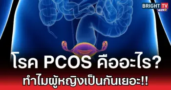 โรค PCOS คืออะไร